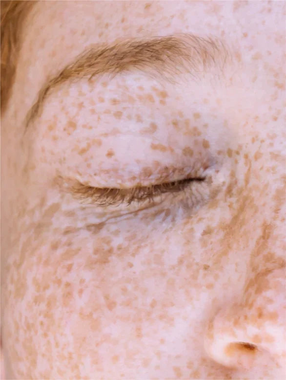 Rozjasňující sérum s vitamínem C