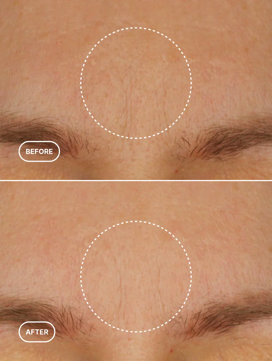 Obnovující krém s retinolem