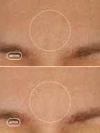 Obnovující krém s retinolem